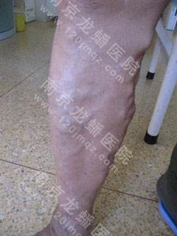 男科症状